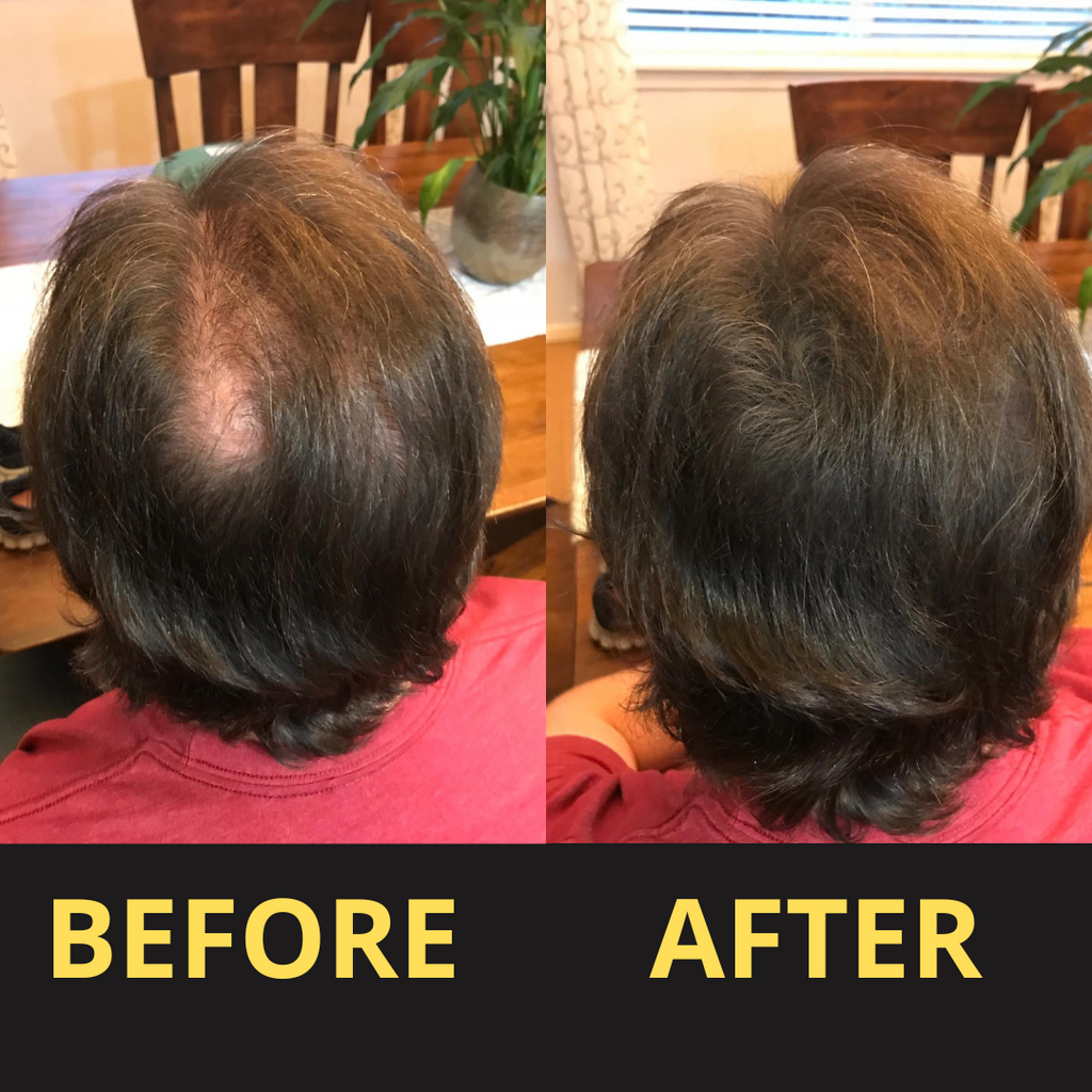 Hairfillup Hair Concealer by Billtin