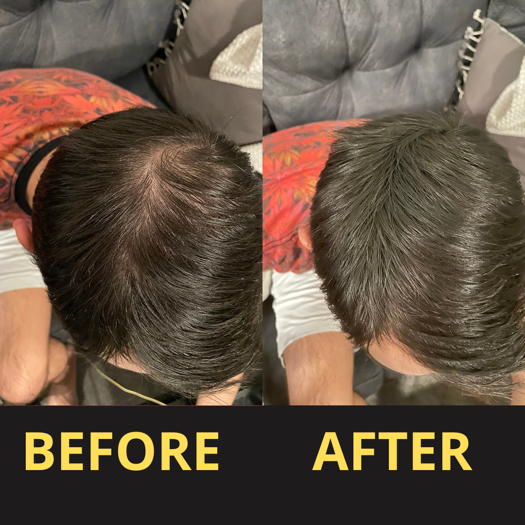 Hairfillup Hair Concealer by Billtin