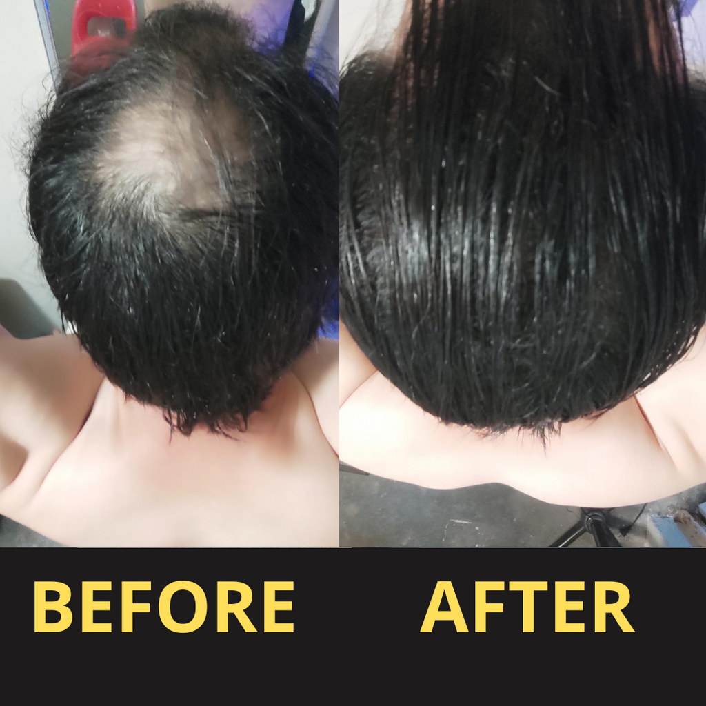 Hairfillup Hair Concealer by Billtin