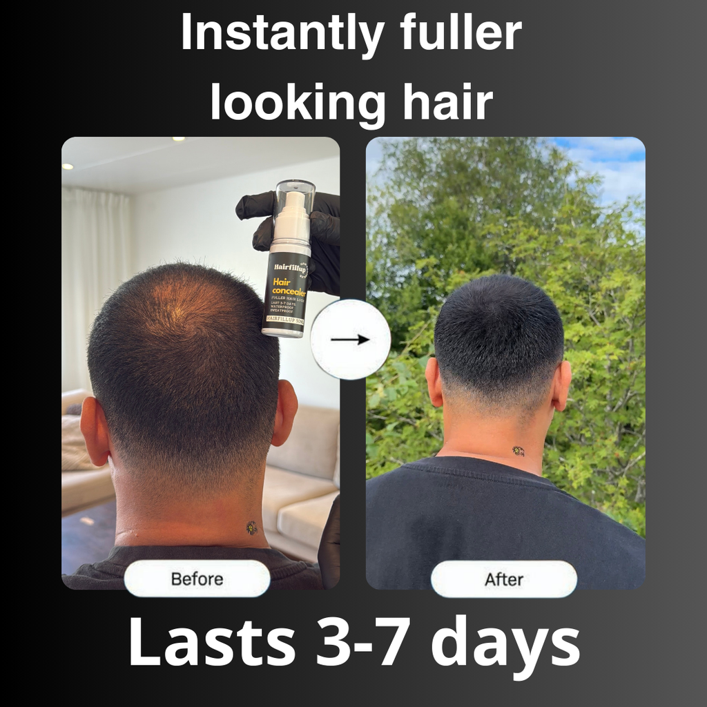 Hairfillup Hair Concealer by Billtin